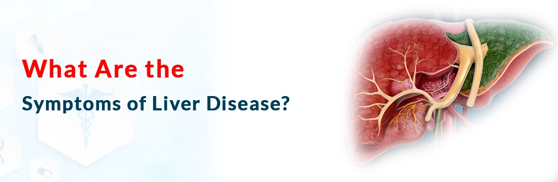  What Are the Symptoms of Liver Disease?